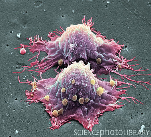 M1320606-Cancer_cell_division-SPL.jpg