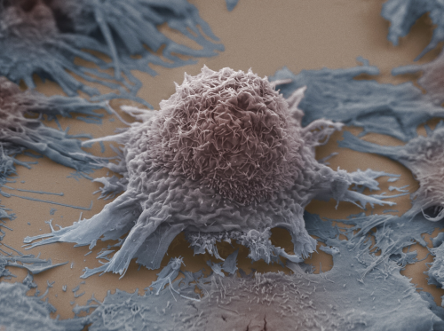 crt-mrct-cancer-cell.jpg